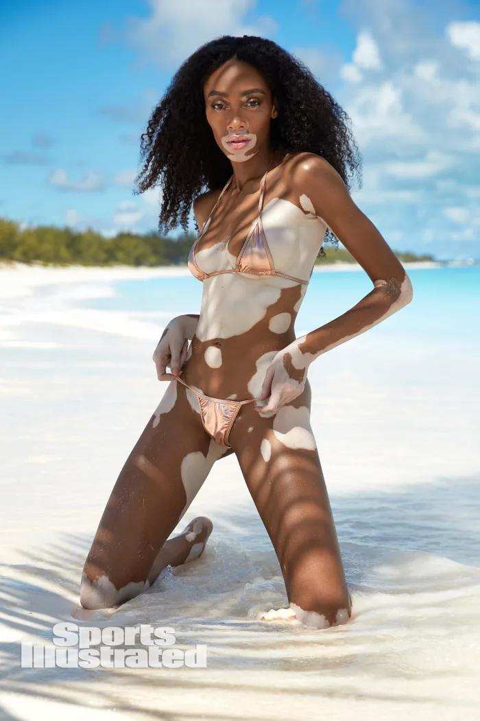 Winnie Harlow